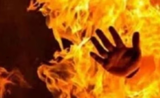 'Barbaric Act': Class 11 girl set afire by ex-boyfriend in AP