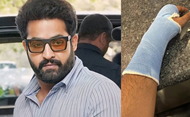 Jr NTR Sprains Wrist While Working Out