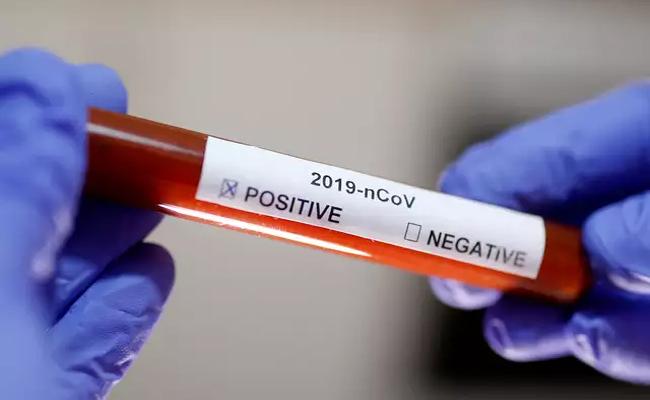 Two more test positive in Telangana