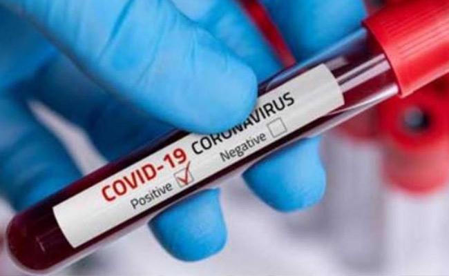 Andhra Pradesh crosses one crore Covid tests